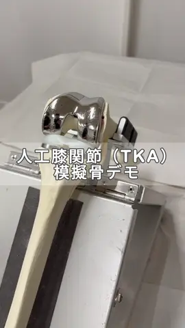 【人工膝関節（TKA）模擬骨デモ】 普段は見られないTKAデモの様子を特別に公開！ 膝の痛みがある方への、人工膝関節ですが、こんな流れで手術しています。 手術を検討している方や普段のリハビリの一助になれば幸いです。 #整形外科医 #tka  #ope #人工膝関節  #理学療法士