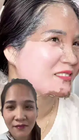 #Malthidar #ထောပတ်စေ့နဲ့တင်းတိပ်အမည်းစက်ရှင်းမယ် #တင်းတိတ်ပျောက်စေတဲ့သဘာဝနည်းလမ်း #knowledgesharing #mandalay @Ma Thi @Malthidar(တင်းတိတ်ပျောက်ဆေး) 