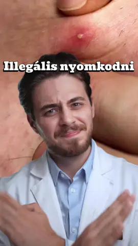 Hirdetés Ha te is bűnös vagy, próbáld ki inkább az új Effaclar Duo+M Tapaszokat, amik azon túl, hogy ideális környezetet biztosítanak a gyorsabb gyógyuláshoz, még a káros szokás leküzdésében is segíthetnek. Kombináld az Effaclar Duo+M bőrápolóval, hogy egyre ritkábban kelljen ellenállnod a kísértésnek, mivel segíti a pattanások megelőzését. @La Roche-Posay  #Effaclar #DontPopIt #effaclarduo #acneproneskin #skincare