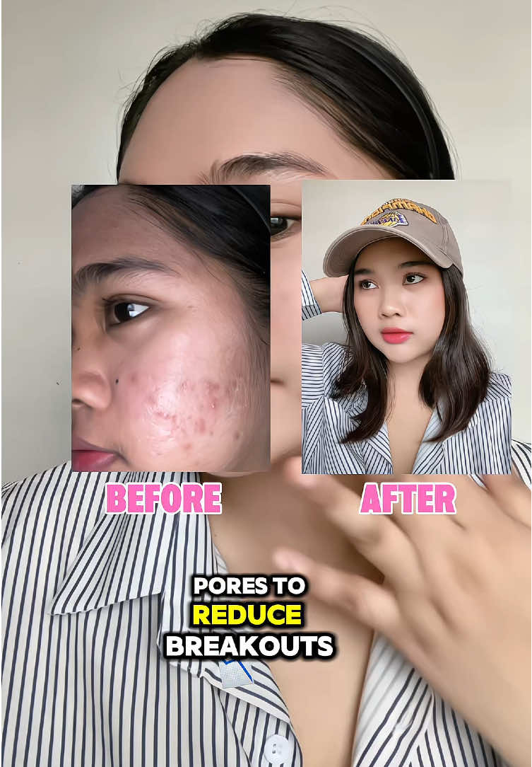Glowing skin? Use @Skin Fantasy Main Rejuvenating Facial Set for radiant skin!✨ #SkinFantasy #RejuvenatingSet #Sunscreen 