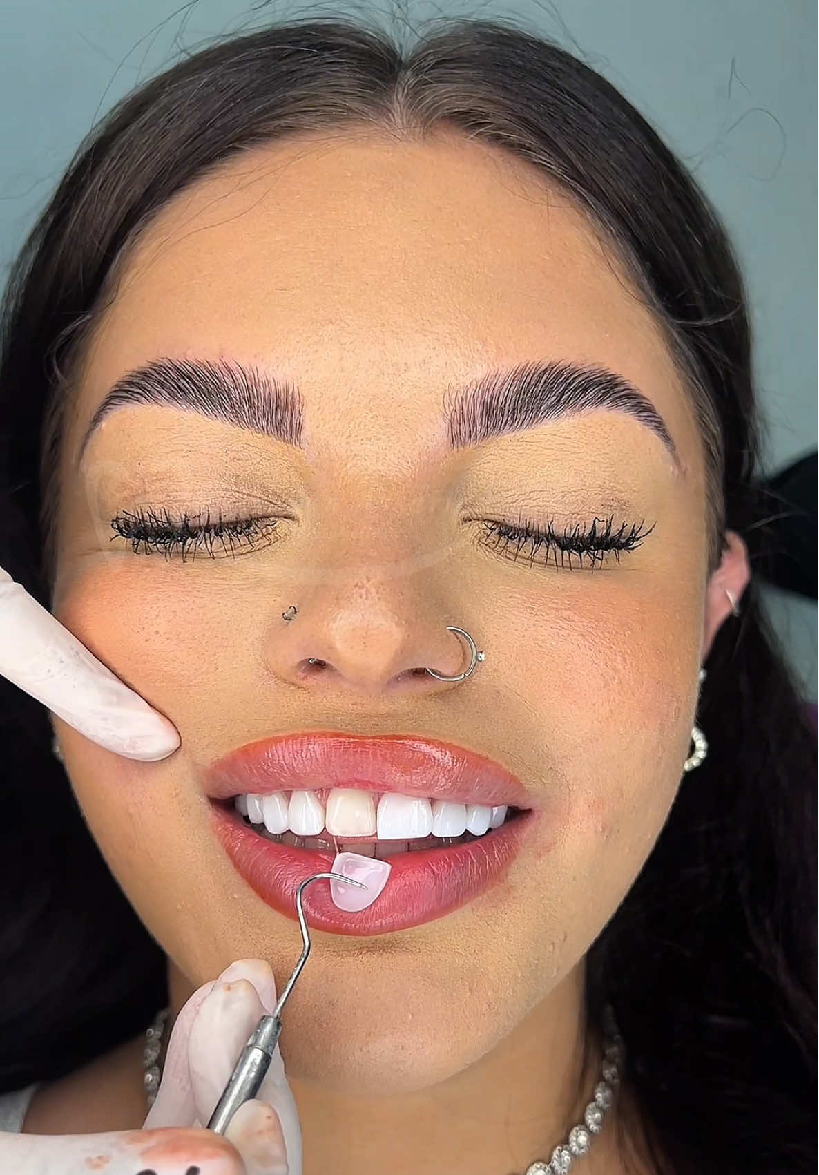 ✨ I’m Dr. Suzan Assarian ✨ With over 10 years of experience in cosmetic dentistry and more than 30,000 non-shaving veneer cases successfully done, I’ve dedicated my career to creating natural, confident smiles 💎 Your dream smile can be effortless — no shaving, no damage, just perfection 💫 📍 Visit us at Dr. Suzan Clinic, Dubai 📞 Booking : +971 56 922 8802 📩 DM us to book your consultation I’m here to make you more beautiful than you are  Without shaving or damaging your beautiful natural teeth. @drsuzanclinic  @drsuzanclinic    #drsuzan  #nonshavingveneers  #veneers #veneer #hollywoodsmile #GlowUpCetaphil 
