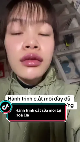 Hành trình cắt môi nè  ….chắc nhiều c em thích lắm 😆 #catmoi #catmoidep #catmoitraitim #moi #catmoitaokhoecuoi 
