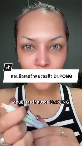 คอนซีลเลอร์กลบรอยสิว #drpong #drpongshop #คอนซีลเลอร์ #รีวิวบิวตี้ #ป้ายยาบิวตี้ 