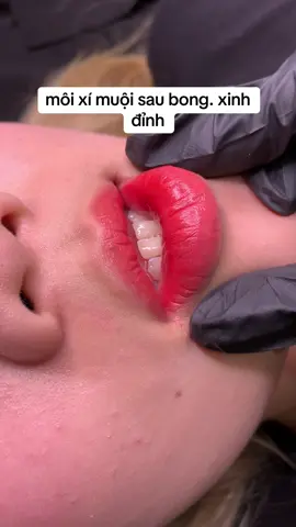 môi pen sau bong. lòng đậm viền nhạt. bong xinh xỉu . sau 2 tháng nữa thì đẹp khỏi bàn nhé