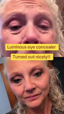 As we age it gets harder to cover these eye bags!! Really liking this @DRMTLGY #eyeconcealer #drmtlgy #eyebags #aging 