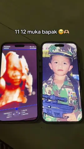 idungnya apalagii #lovedisel 