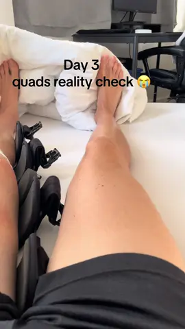 Day 3 quads acl + meniscus #kneesurgery #acl #meniscus 
