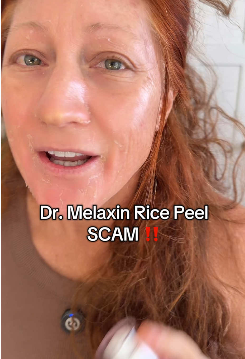 Everyone’s talking about the Dr. Melaxin Rice Peel… but here’s the truth: that “skin” coming off is mostly just the product reacting with your natural sebum. The Dr. Melaxin Rice Peel is not actually removing dead skin. If you really want to exfoliate and remove the top layer of dead cells, you need the Dr. Melaxin Cemenrete Cynopink Spicule + Picatonic Shot. This duo works from within — stimulating cell turnover, pushing out dull skin, and helping your face renew naturally. Don’t waste your money on the hype. If you’ve tried the Dr. Melaxin Rice Peel, this is what you actually want. 🌿 #DrMelaxinRicePeel #ExfoliationThatWorks #DeadSkinRemover #SpiculeTreatment