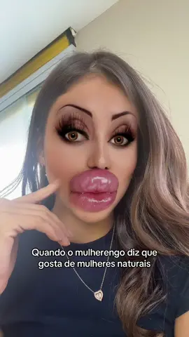 Passa 1L de hialurônico pra cá 👀