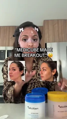 Replying to @certifiedhaterr69 Yes babe, that’s just purging ✨ your skin’s pushing out all the gunk + oil. It usually clears up in a week or two, leaving you with glass skin 💖 #koreanskincare #purging #acne #tiktokshopcreatorpicks #acnetreatment 