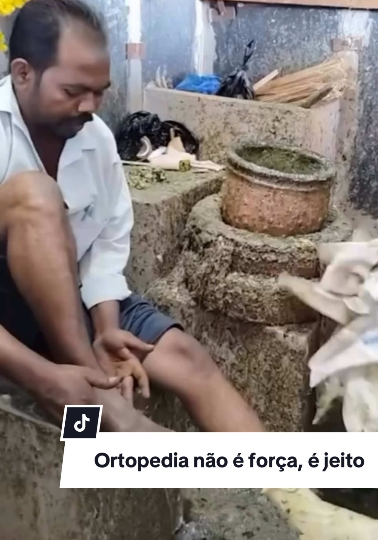 😳 Já viu isso? 🦴Não existe tratamento de fratura na base do chute. Ortopedia não é força bruta, é técnica e precisão. Cada movimento errado pode agravar a lesão, gerar deformidades e até complicações permanentes. 💡 Dica de ouro: Se você ou alguém próximo sofrer uma fratura, imobilize o local e procure atendimento médico especializado imediatamente. O que parece “rápido” pode custar caro no futuro. 👉 Salve esse vídeo para nunca esquecer. 📲 Siga @drbrenogomes para mais conteúdos de ortopedia sem enrolação. #fratura #ortopedia #urgencia #acidentedomestico #prevencao 