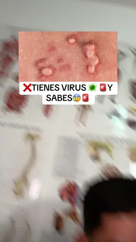 no esperes mas si tienes algunos de estos problemas‼️ #heraure #papilomahumano #viruspapilomahumano #probioticos #saludfemenina 