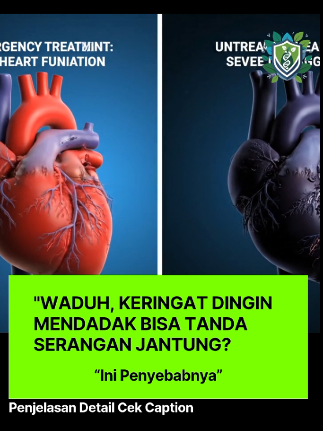 Serangan jantung terjadi saat aliran darah ke otot jantung terhenti akibat sumbatan di pembuluh koroner. Kondisi ini darurat medis ⚠️, karena setiap menit yang terbuang bisa merusak otot jantung lebih banyak. 👉 Gejala yang wajib diwaspadai: Nyeri/tekanan di dada Sesak napas Keringat dingin & mual Nyeri menjalar ke lengan, leher, atau rahang Pencegahan bisa dengan pola hidup sehat: olahraga, kontrol kolesterol, stop merokok, dan kelola stres. 📌 Menurut kamu, kenapa banyak orang suka mengabaikan nyeri dada dan bilang “cuma masuk angin”? Yuk diskusi di komentar 👇 📲 Konsultasi gratis via WhatsApp: 0895322575029 #fyp #edukasikesehatan #kesehatan #imun #fyppppppppppppppppppppppp 