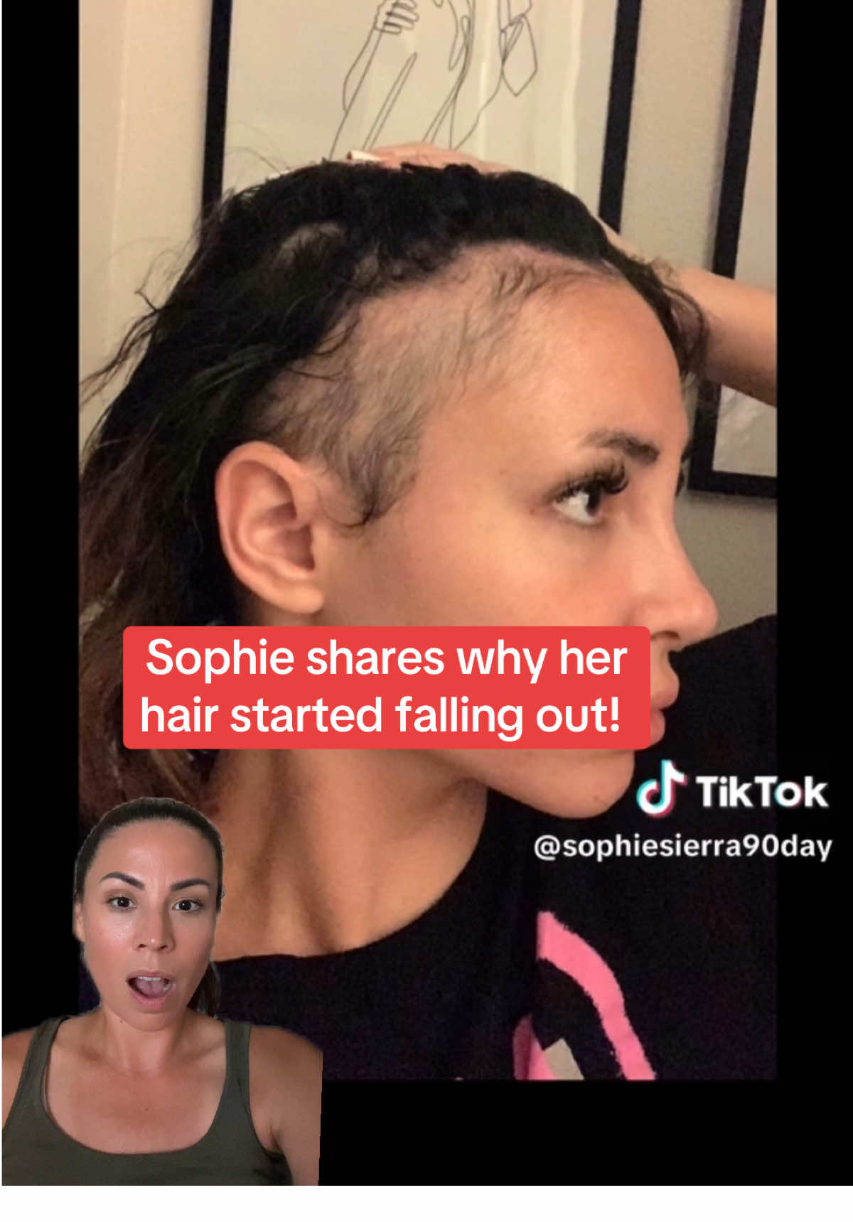 90 Day Fiancé’s Sophie shares why her hair started falling out!  #90dayfiance #90dayfiancé #90dayfiancehappilyeverafter #greenscreen 