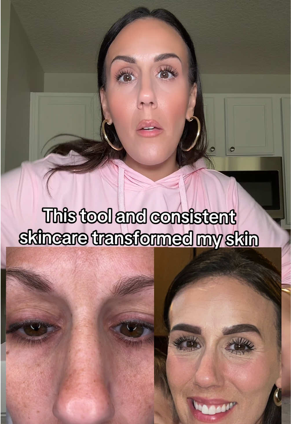 I love this skincare device ! #skincare #skincaretools #highfrequencyfacial #skincaredevice #matureskin @Pure Daily Care 