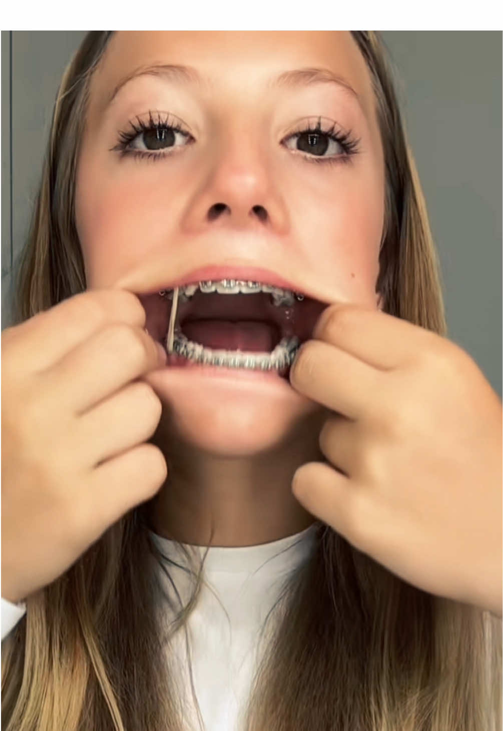 thanks for 10k here! bops for everyone #mouthybops #bops #tongue #braces #boptok 
