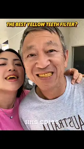 The Best Yellow Teeth Filter 💀#magicmoment #challenges_tiktok #magiccoolingmagicnowid #challenges_tiktok #magicmoment 