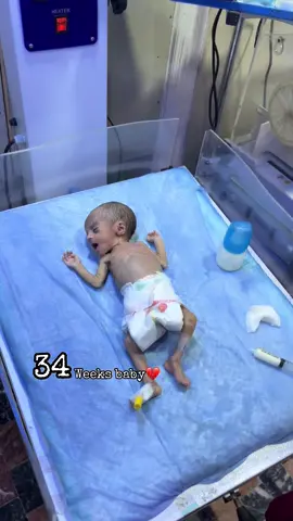 Syringe feeding to a premature 34 weeks baby🥹💔 #nicucare #PreemieWarrior #viral #foryou #tiktokdoctor 