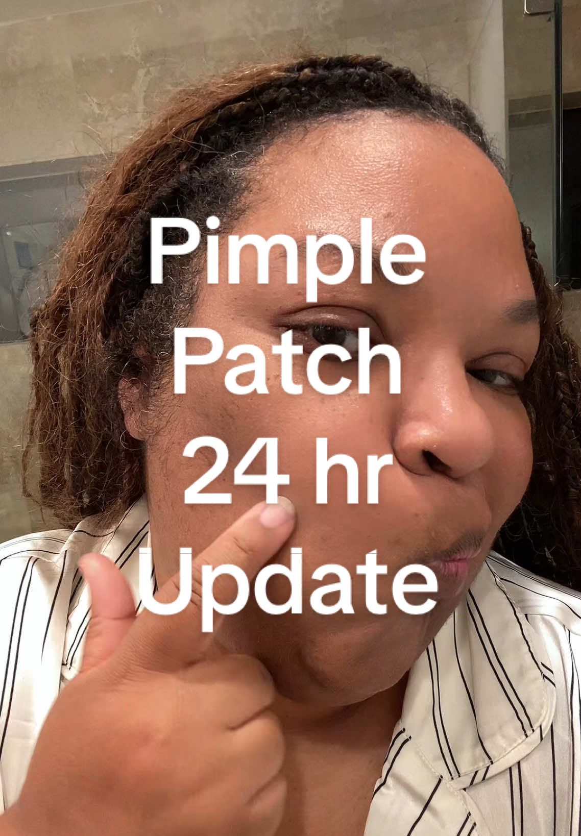 Even dermatologists have bad skin days 😩. Thank goodness for pimple patches and prescription acne regimens 🙏🏾. My skin is going through it this month! Link in bio 🔗 #pimplepatches #pimplepatch #acne #skinauntie 