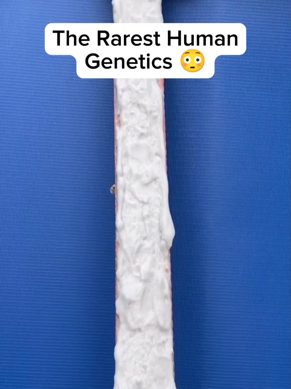 The Rarest Human Genetics 😳#fyp #interesting #explore #human #genetics 