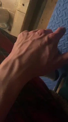 What u think? #veinyhands #vascular #armveins #hands #fyp 