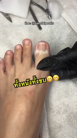 💓 #namthipnails #ตัดเล็บขบ #ตัดหนัง #ทำเล็บ #ร้านตัดเล็บขบ      Fb : namthipnails  Line : @namthipnails  นัมเบอร์วัน8 ตลาดม.ราม2  กทม  Map: namthipnails  https://goo.gl/maps/JmwpCKLfKwmhKGK96  ร้านเปิดทุกวัน เวลา12.00น-22.00น.