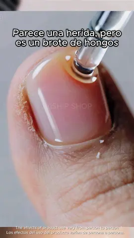 Deja de gastar en productos que no funcionan, esta es la clave del cuidado.#toenails #laborday #laborday2025 #happylaborday #trend 
