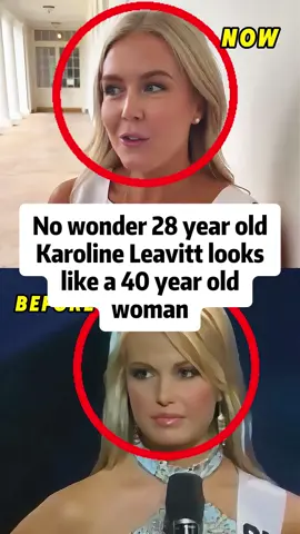 No wonder 28 year old Karoline Leavitt looks like a 40 year old woman.#usa #fyp #foryoupage #tiktok #celebrity #trump #karolineleavitt #trending #actor 