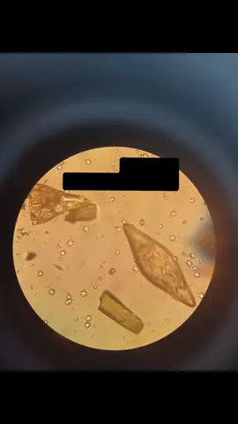 #CapCut #CapCutAmor #crystals #مختبرات #مختبرات_طبية👩🏻‍🔬💉 