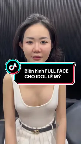 Biến hình cấy HA full Face cho IDOL LÊ MỸ #filler_boxtox #cấy_ha #cân_chỉnh_mặt_fullface #fillers💉 #cân_chỉnh_mặt 