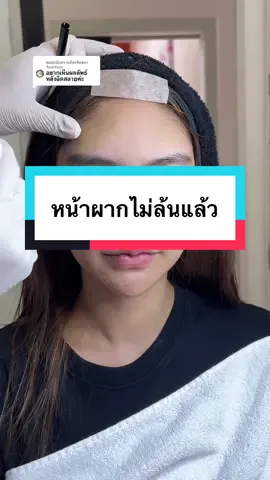 ตอบกลับ @TomYum หลังจากฉีดสลายก็กลับไปเป็นหน้าผากเดิมค่ะ วันนี้มาเติมใหม่แล้ว หน้าผากนูนพอดี เลยค่า  #เท#เทรนวันนี้ป#โปรแกรมฟิลเลอร์ปรับรูปหน้าป#โปรแกรมฟิลเลอร์า#อาเต้เฮ้าสคลินิกสระบุรีม#หมอฟาร์มอาเต้เฮ้าสคลินิก
