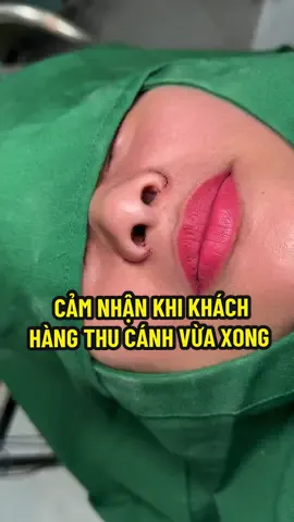 Đã thu cánh mũi bên nhà Thúy Lê xong ,thì bao nhiêu lời nói như thu cánh không nâng mũi được , thu cánh xong bị dẹp không tròn cánh mũi . Video này xin gửi đến những khách hàng mất niềm tin về thu cánh mũi nhé. #thucanh #thucanhmuikhongseo #lamdeptuthiennhien 