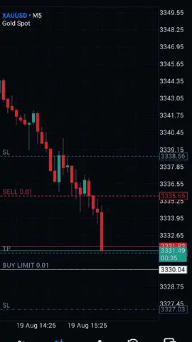 🤕 #xauusd #forex #fyp #trading #trader 