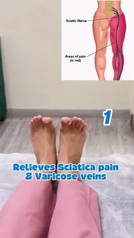 Relieve sciatica and varicose veins