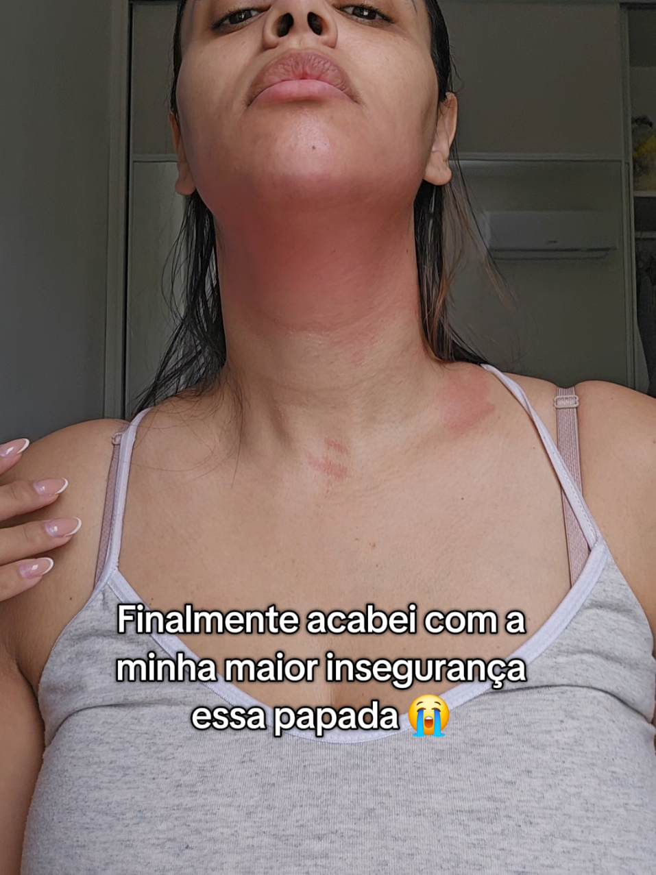 Finalmente consegui me livrar dessa papada usando o creme rosa. #cremerosa #gordura #creme #papada #autoestima 