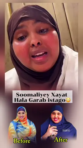 Alle haku cvio wll #shoodhe #xayaatpretty #fyp #somalitiktok🇸🇴 #somalitiktok🇸🇴 