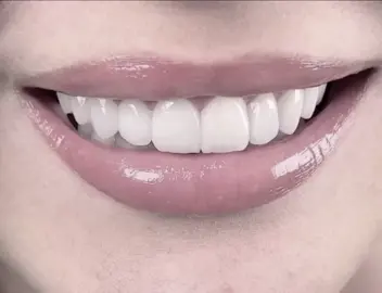 بەیەک حەرەکە😂.                                                        #foryou #tikvls #tiktok #froyoupage #fypシ #viral #fyyyyyyyyyyyyyyyy #sound #teeth #smile #hate @TikTok 