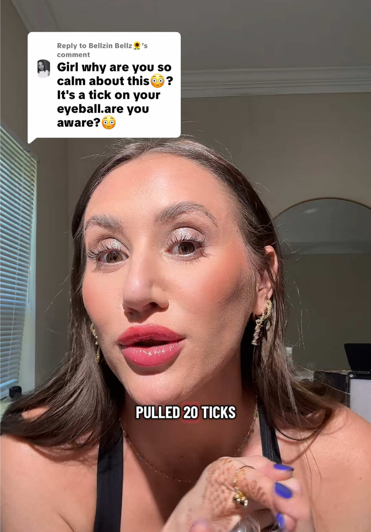 Replying to @Bellzin Bellz🌻 reflecting on the tick that latched onto my eye #ticks #midwest 