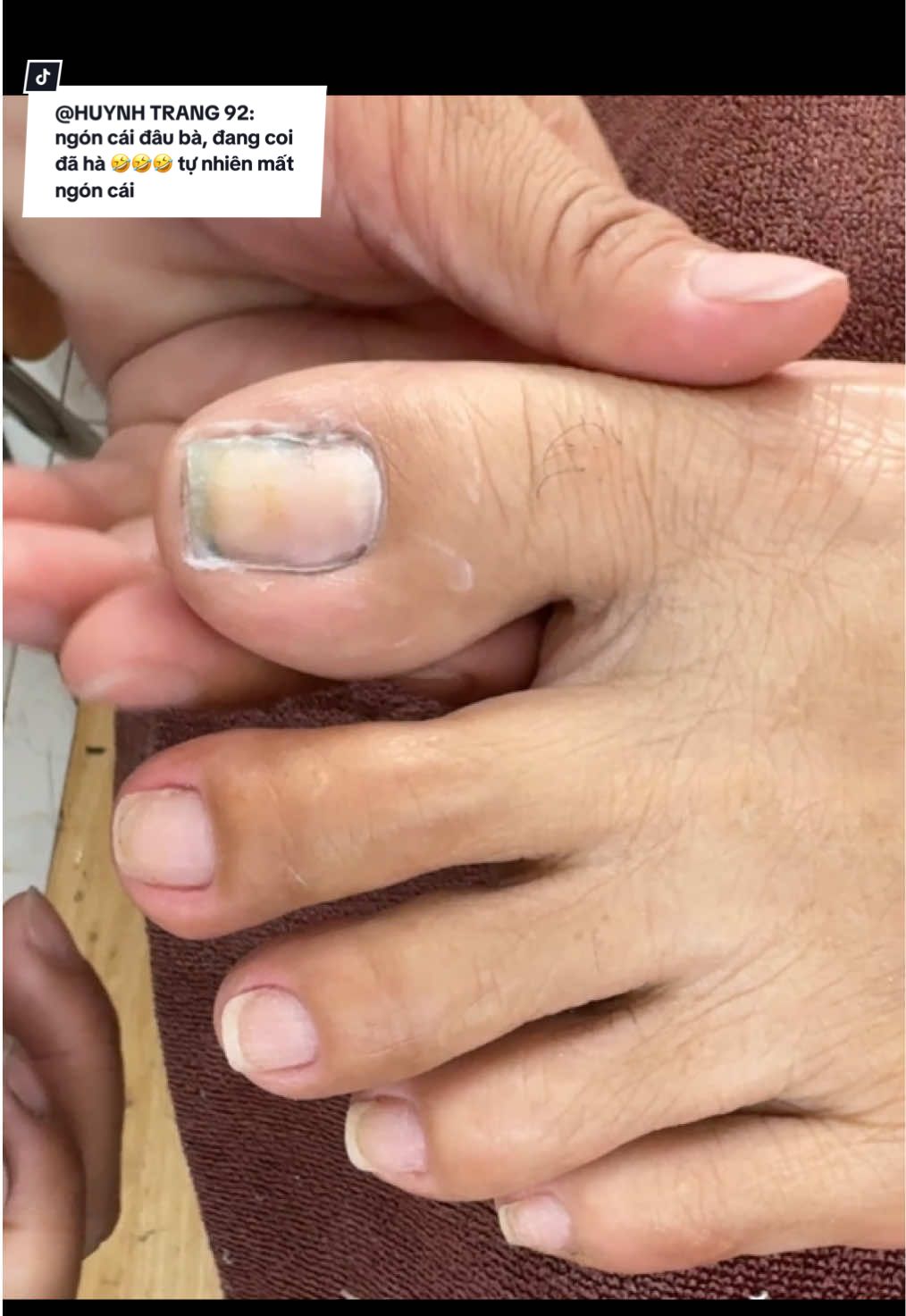 ngón cái nè bà🤣🤣#trending #xuhuong #tiktok 