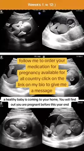 Do You know That Women That Are 40yrs and Above Mostly Have Infertility Challenges like; Low Egg Quality, Menstrual Loss, PCOS, blocked Tubes, Ovarian Cyst, Fibroid And Even Infection Can Still Give Birth Naturally. See The Latest Discovery On How To Give Birth Without Any Expensive 1 Treatment.#pcos 1 #pcosweightloss #miscarriage #miscarriageawareness #ovulation 