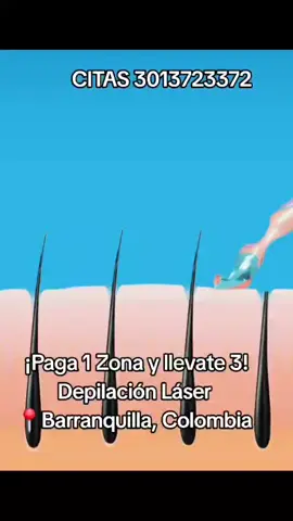 DEPILACION LASER DEFINITIVA  #viral #laser #barranquilla 