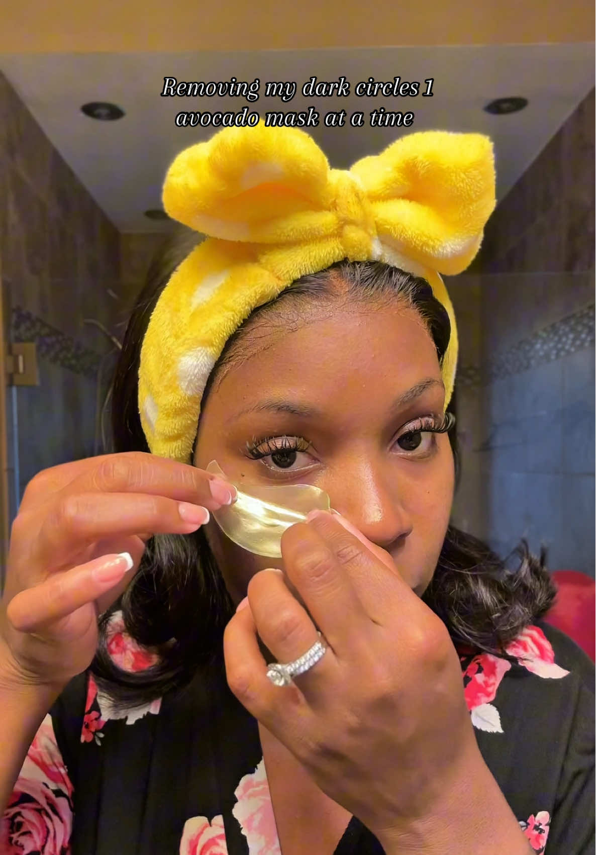 Removing my dark under eyes 1 avacado mask at a time! 💓 #darkspots #darkcircles 