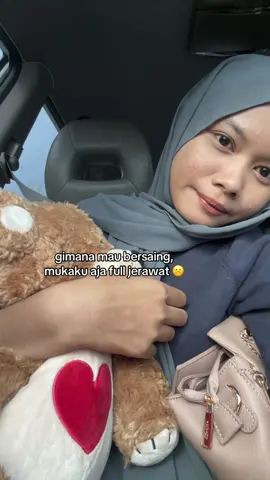 mcm mna nk clearskin #4u #fyp #xyzabc 