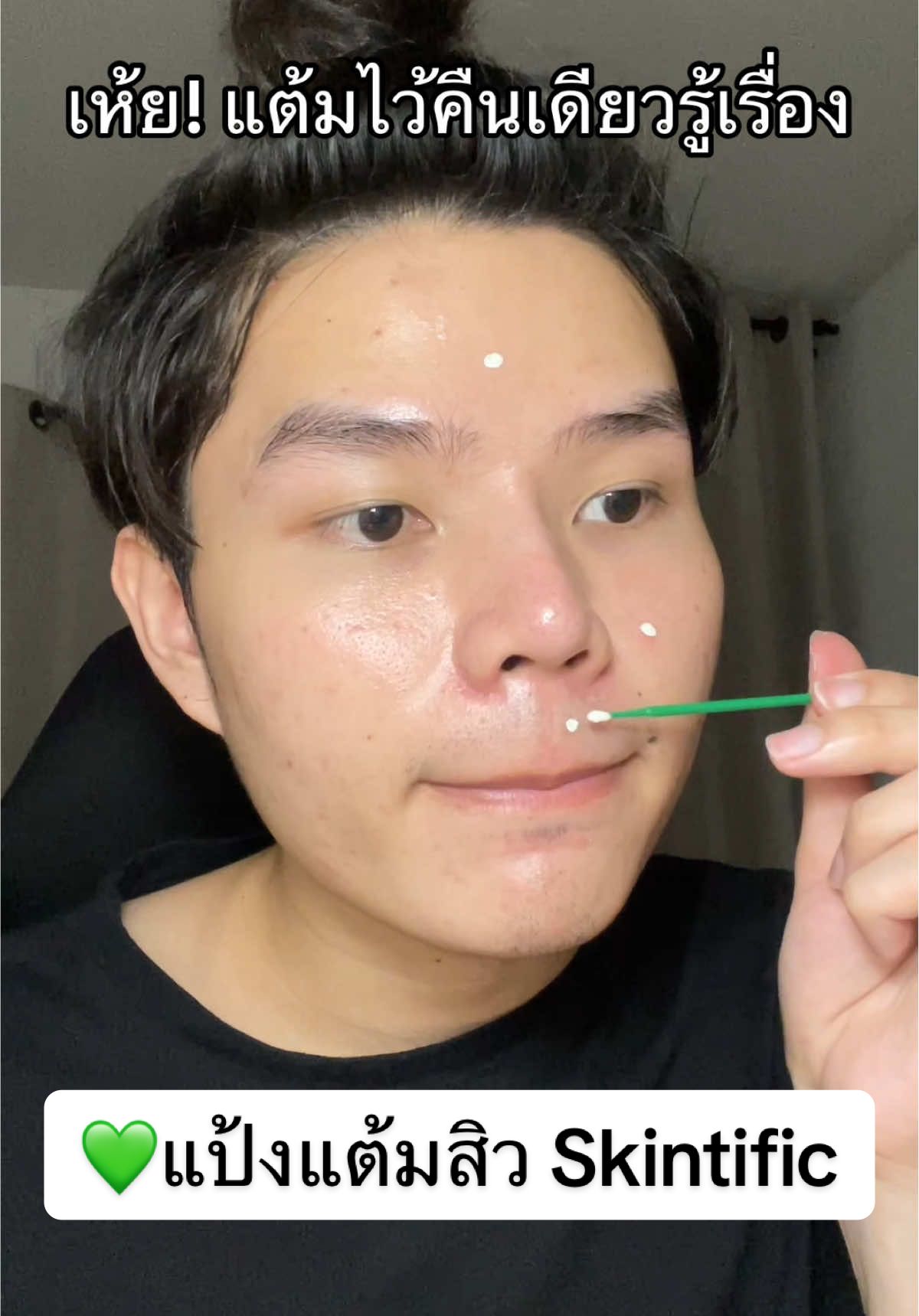 ก็ไม่คิดว่าจะยุบไวขนาดนี้ ทำถึงเกินคุณน้า👏🏻 #รีวิวบิวตี้ #แป้งน้ําแต้มสิวฝาเขียว #แป้งน้ำสงบสิว #SkintificTH #tiktokป้ายยา 