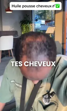 Dites NON à la chute des cheveux🪮. Vos cheveux chutent ou ne repoussent plus, découvrez l’huile à la Cafféine C1✅ Très facile à utiliser, il suffit d’appliquer quelques gouttes et masser doucement pendant quelques minutes, deux fois par jour. Livraison gratuite et paiement à la livraison ✅🇧🇯  #Cheveux #benintiktok🇧🇯 #cotonou229 #calavi229🇧🇯 #portonovo🇧🇯 