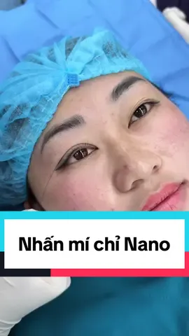Nhấn mí chi bạn khách hàng form mắt dài #nhanmitunhien #nhanmi #nhấnmí #xuhuong #ilovetiktok @