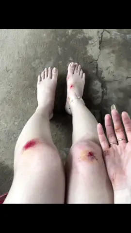 Nay ra đường kiểu xuii 😢🥺