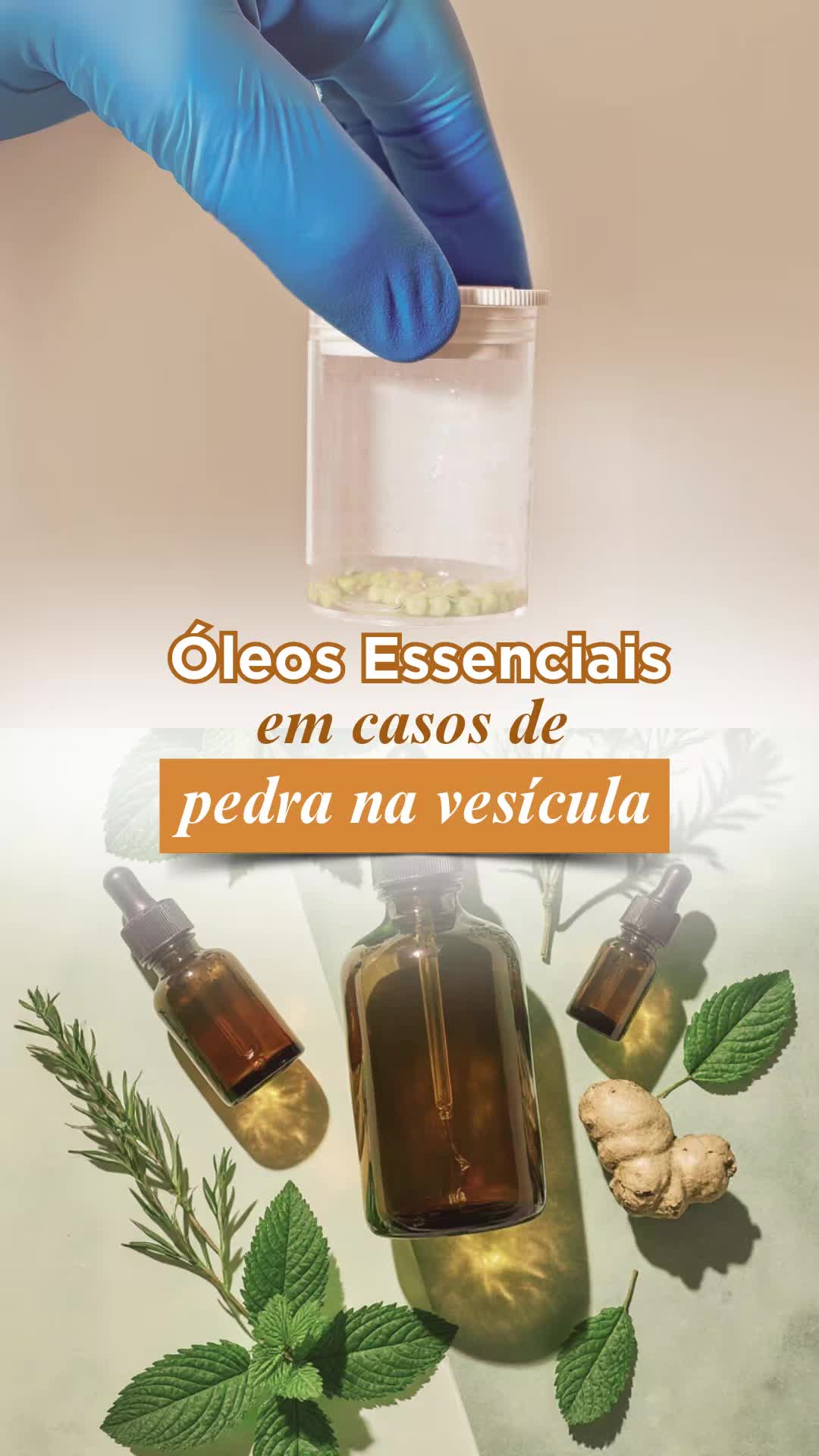 🌿 Você tem pedra na vesícula ou já passou por cirurgia de colecistectomia? Então essa informação é para você! 📌 Estudos mostram que pessoas com pedras na vesícula, especialmente entre 20 e 39 anos, muitas vezes apresentam desequilíbrios no estilo de vida: Consumo excessivo de álcool Obesidade Colesterol elevado 💡 Olhos essenciais podem ajudar! Alguns blends energéticos mostraram efeito na degradação das pedras, como combinações de: Alecrim Hortelã Pimenta Olíbano ✨ Esses óleos apresentam sinergismo, ajudando a reduzir o risco de novas formações de cálculos e a manter a saúde da vesícula. ⚠️ Importante: pedras grandes ou volumosas ainda podem exigir cirurgia — os óleos essenciais não substituem o procedimento, mas são um recurso natural interessante para prevenção e cuidado complementar. 💬 Me conta: Você já conhecia esses recursos naturais para vesícula? Compartilhe sua experiência ou dúvida nos comentários! #PedraNaVesícula #Colecistectomia #ÓleosEssenciais #AlecrimEO #HortelãEO #OlíbanoEO #SaúdeNatural #DraJéssica 🌿💧