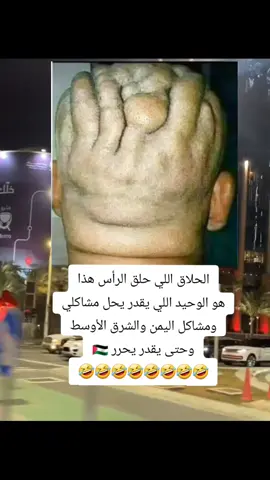#tiktok #fyp #foryoupage #متابعه_ولايك_واكسبلووووووور #صنعاء_تعز_عدن_اب_ذمار_حجة_حضرموت #وطن واحد #🤣🤣🤣🤣🤣🤣🤣🤣 #🖤🤍❤️🥰 