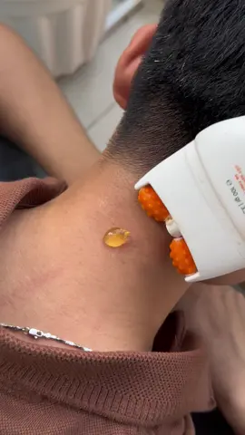 Thử xài thanh lăn massage Cốt Gừng nhà em Nhân thì mấy anh chị cô chú đỡ đau nhức cổ - vai - gáy lắm luôn ạ ! #MocTamPhuoc #ThanhLanMassage #CotGung #ThanhNhanShop #DuongSinh 